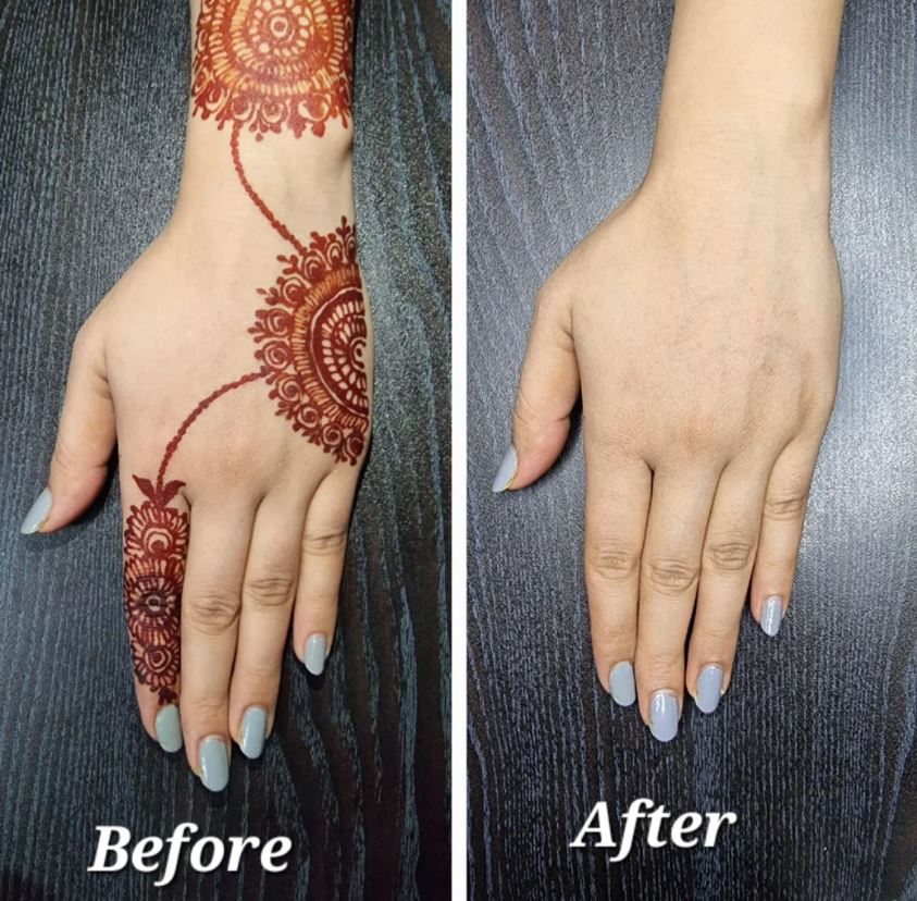 henna removal results after 2 days using lemon baking soda method